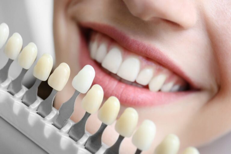 Sorriso branco: Dezembro chegou!!